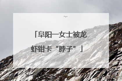 阜阳一女士被龙虾钳卡“脖子”